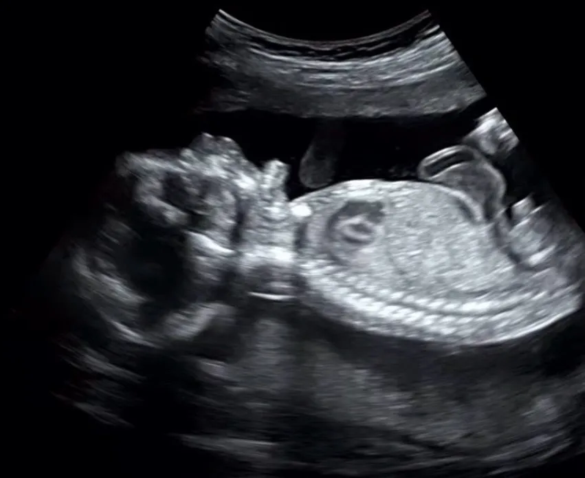 19w6d 아기 하품 하는 모습 포착했어요!