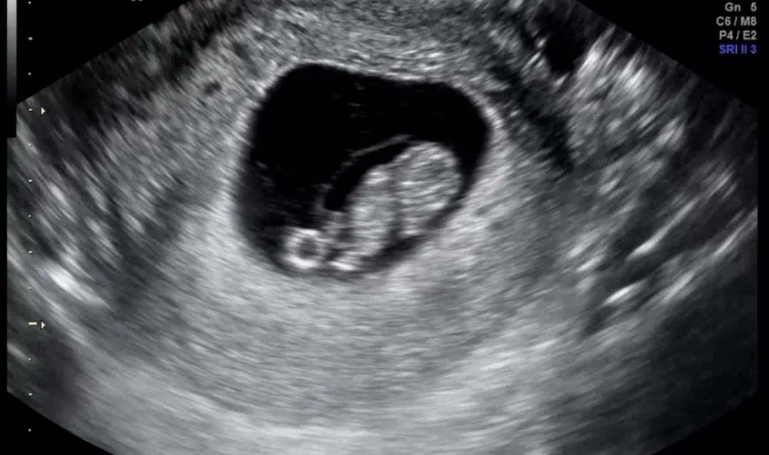 8w6d