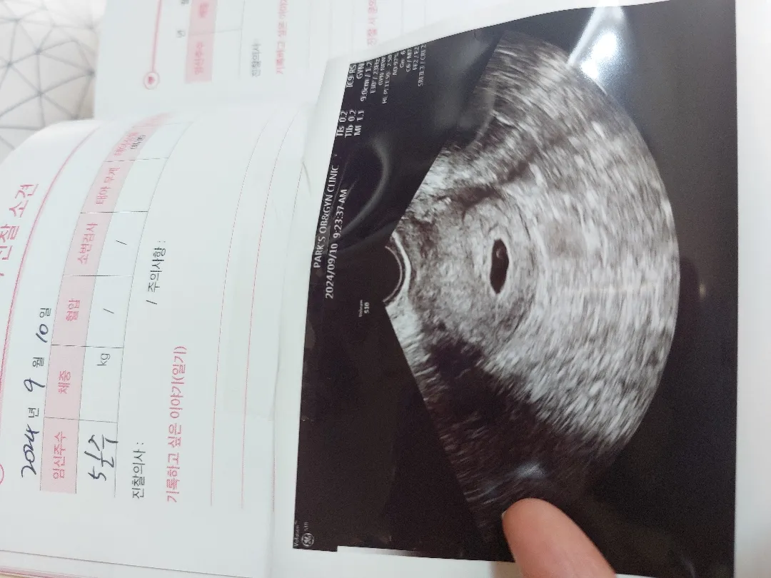 아기집크기는6주인데 난황이랑아기로봤을땐5주래요ㅜ