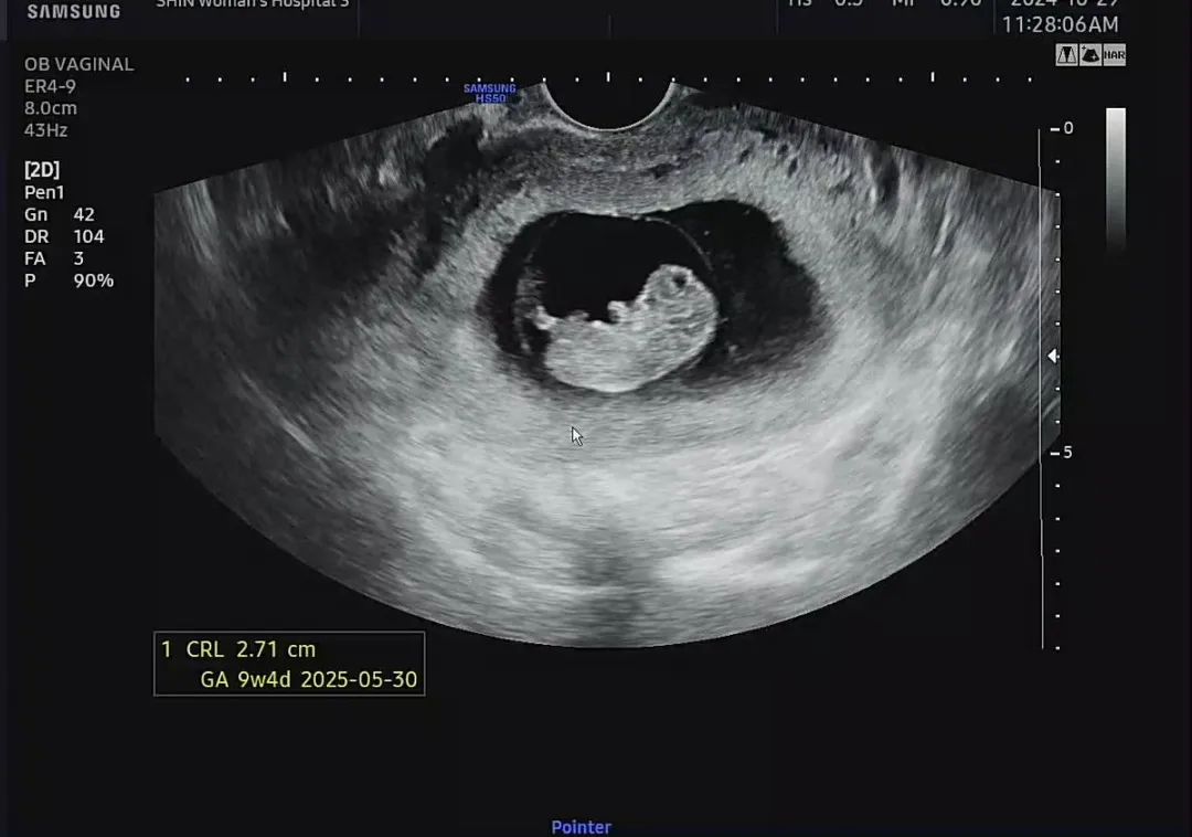 9주5일 젤리곰 보고왔어용❤️