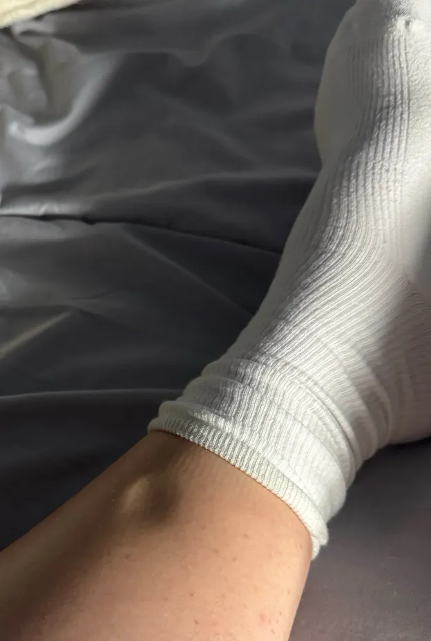 다들 부종 어떠신가요?