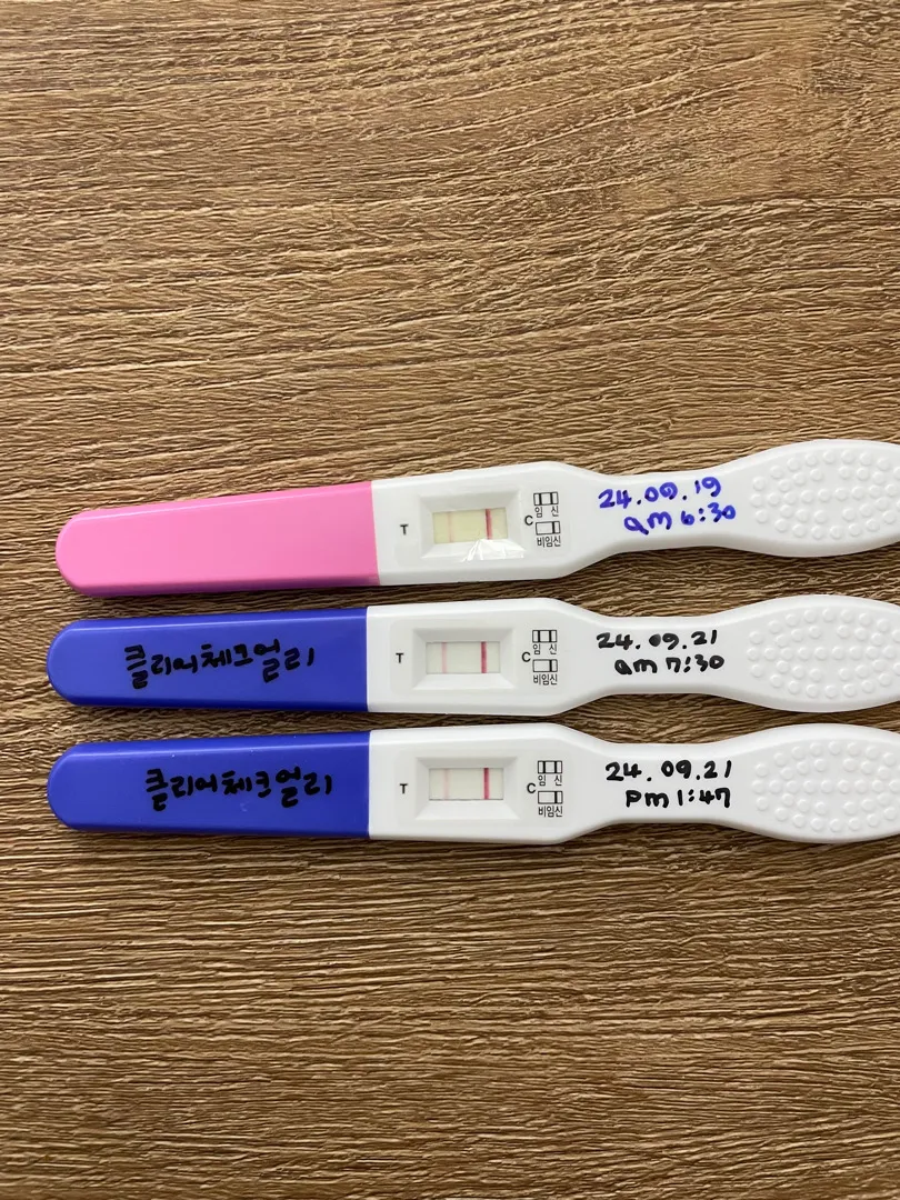병원가봐도 될까용? 임테기봐주세영!
