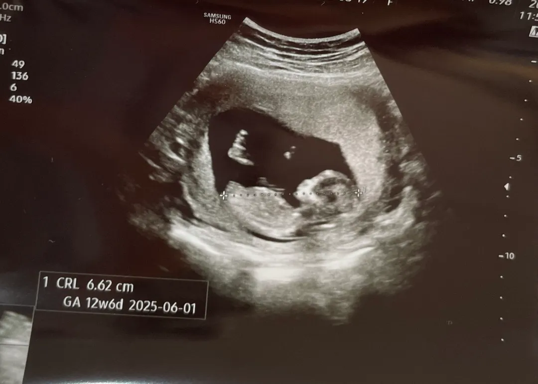 각도법 한번만 봐주셔요...🤍👶