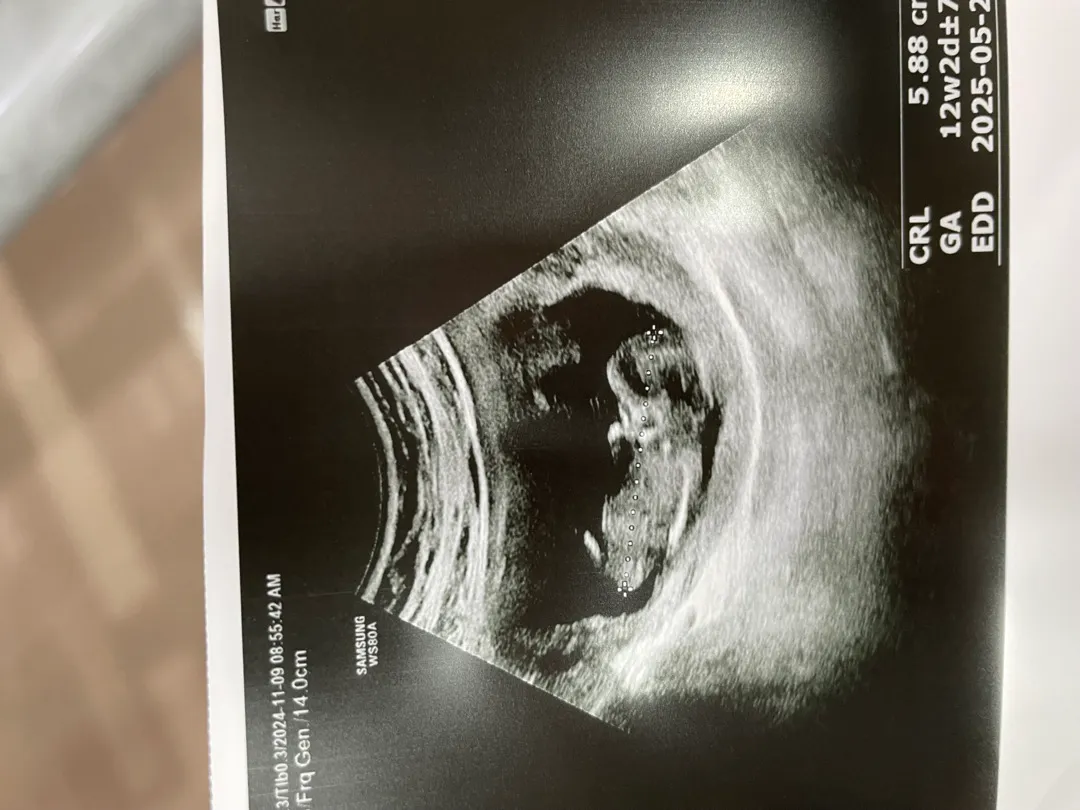 11주4일 각도법 좀 봐주세여