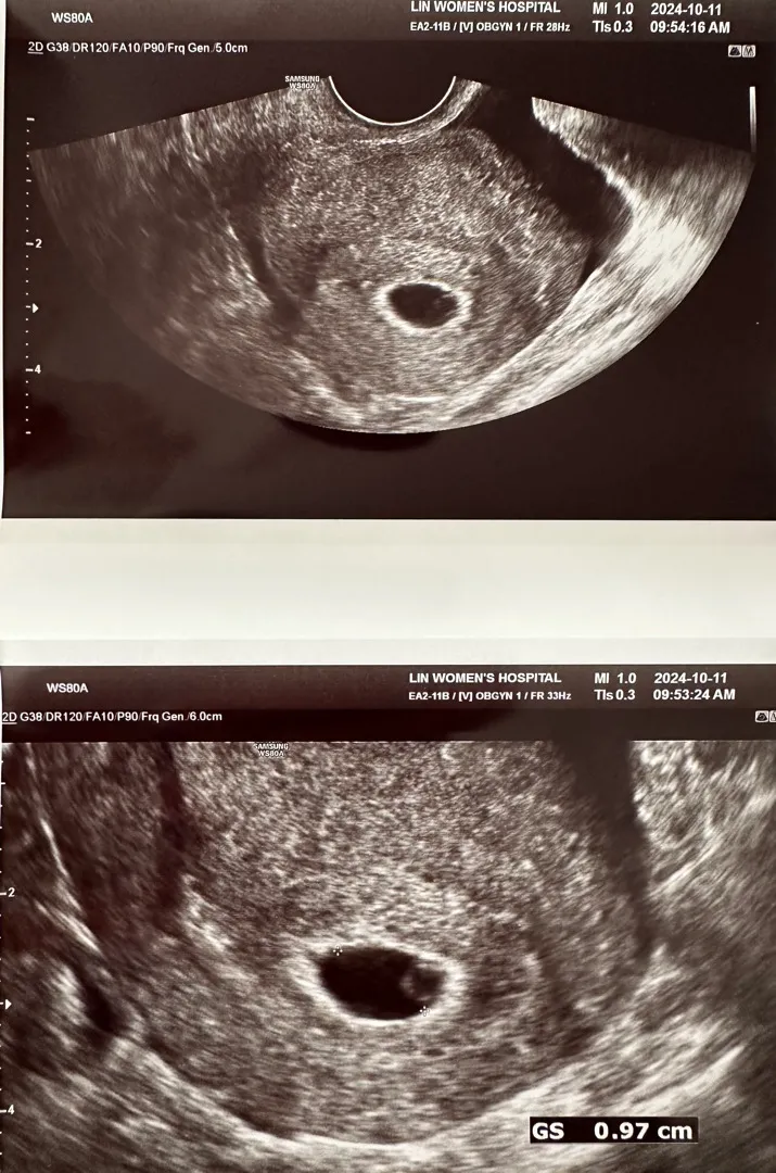 (5주6일) 아기집이 작은건가요?