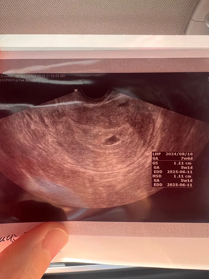 유산가능성이 70퍼래요ㅜㅜ
