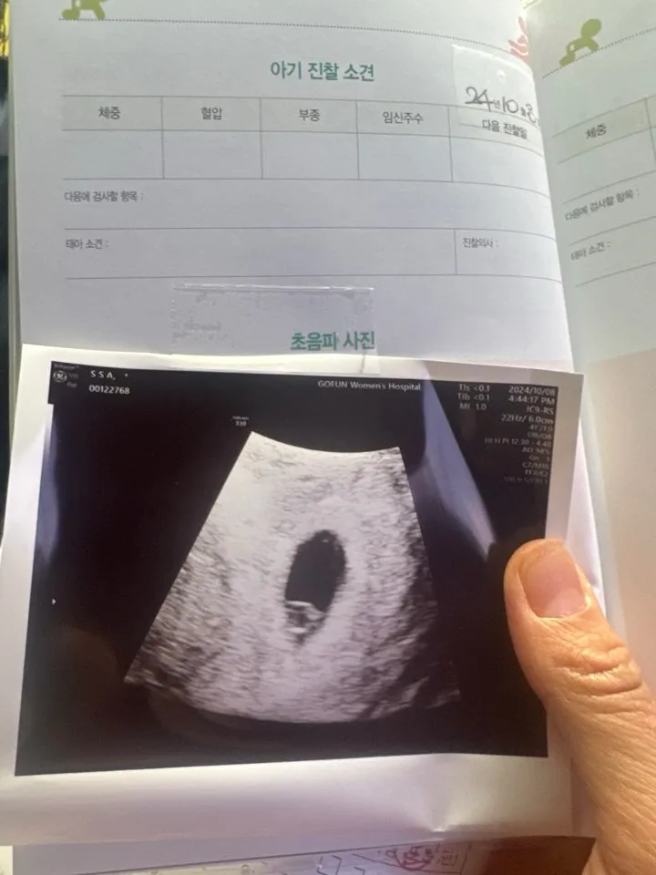 5주차 아기집 보고왔어요 