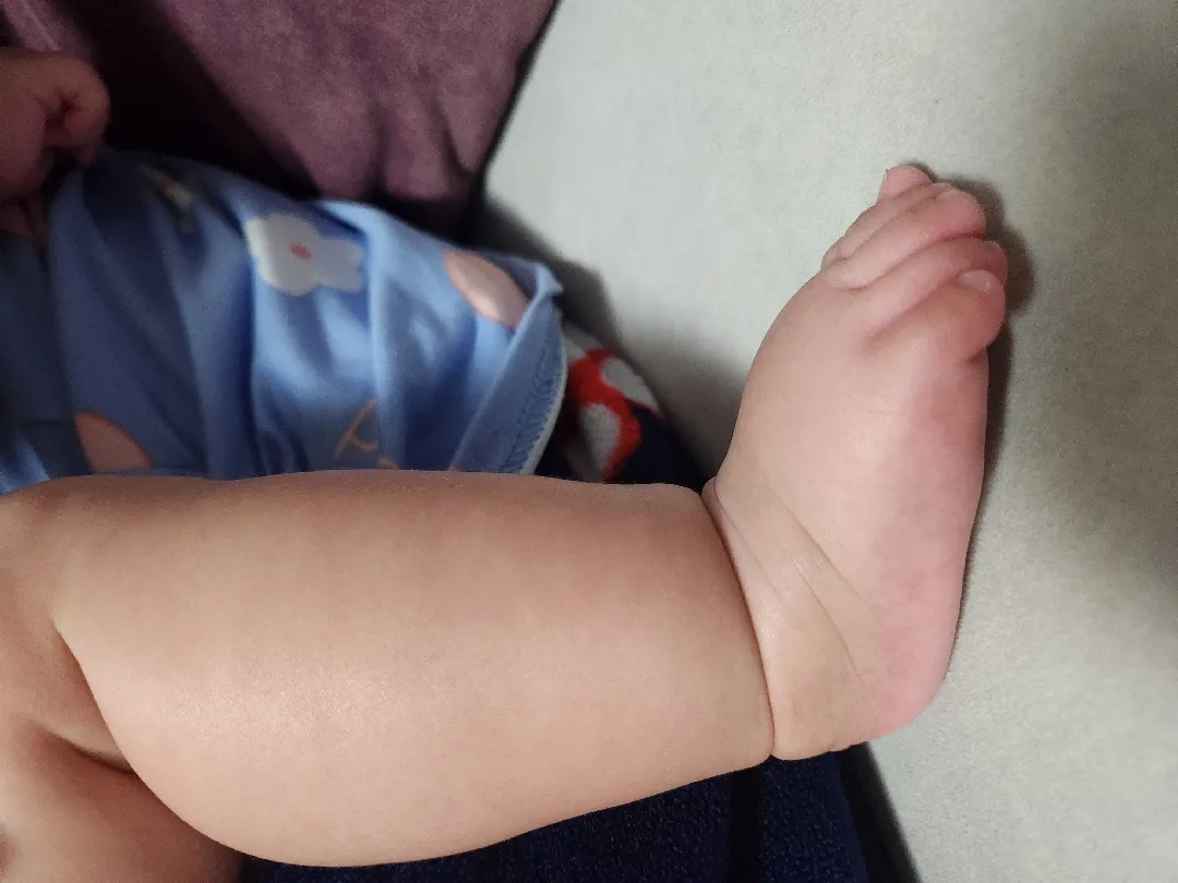 120일 아기 발등 두께가 원래 이정도인가요?