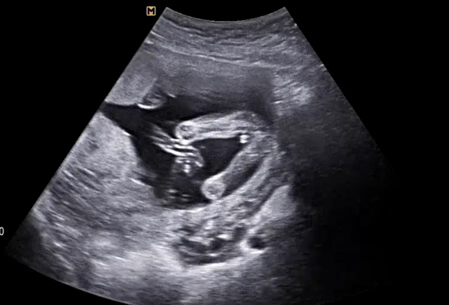 16주6일 성별 반전 없겠죠?