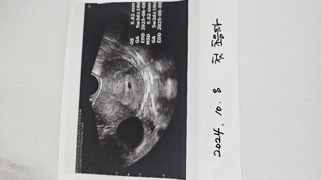 40세 첫아이 자연임신이에요
