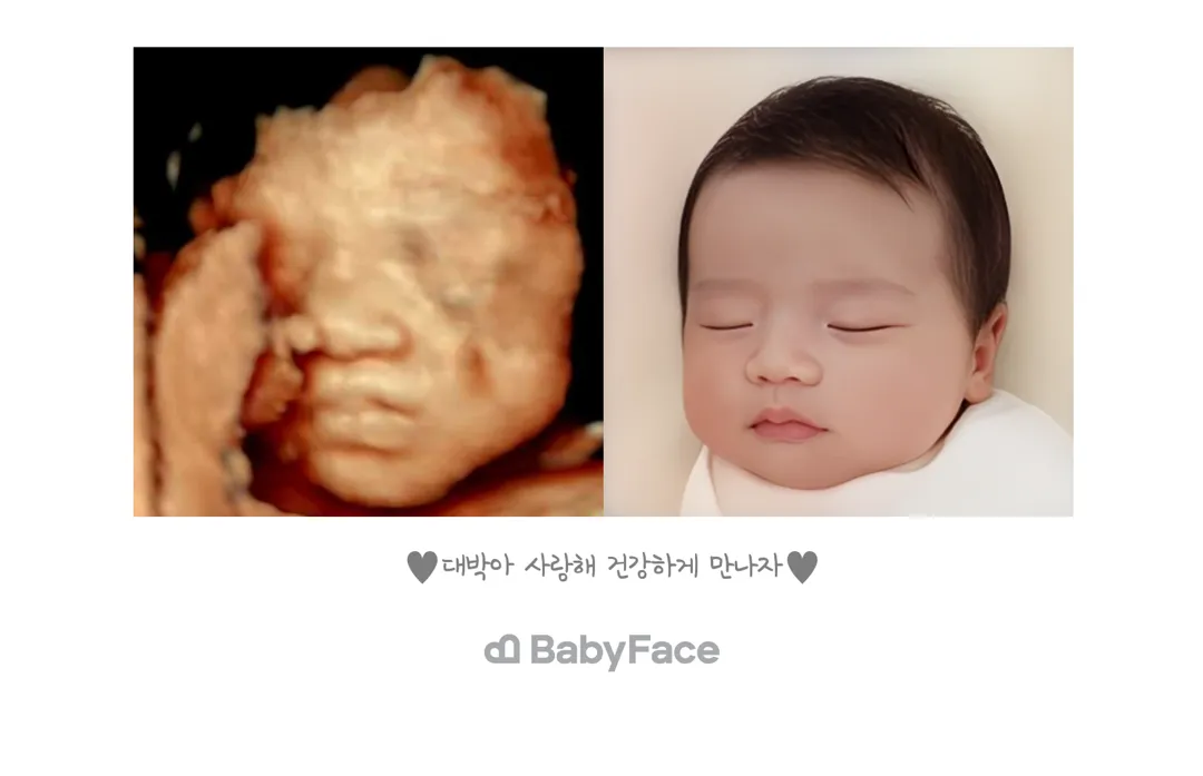 베이비페이스