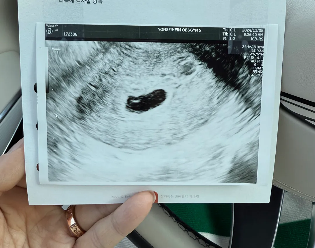 4일만에 아기집은 많이 컸는데 피고임이 있다네용 ㅠㅠ