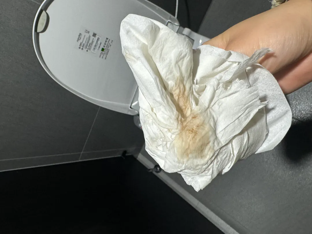 병원 가봐야 할까요?ㅠㅠ
