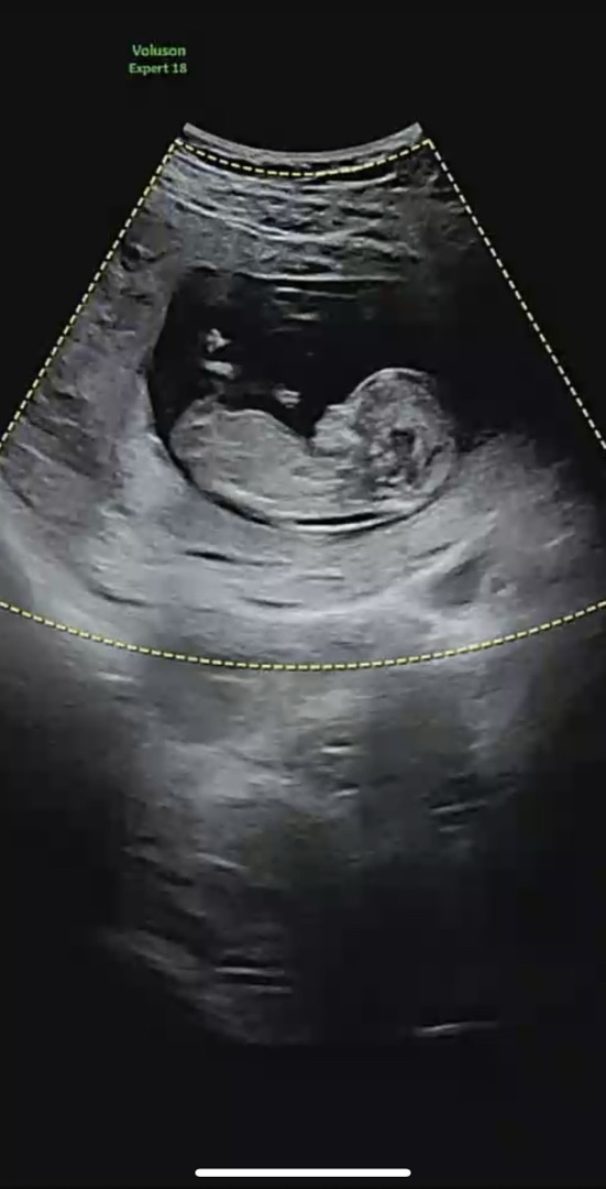 12주3일 각도법 봐주세요 ...!!! 
