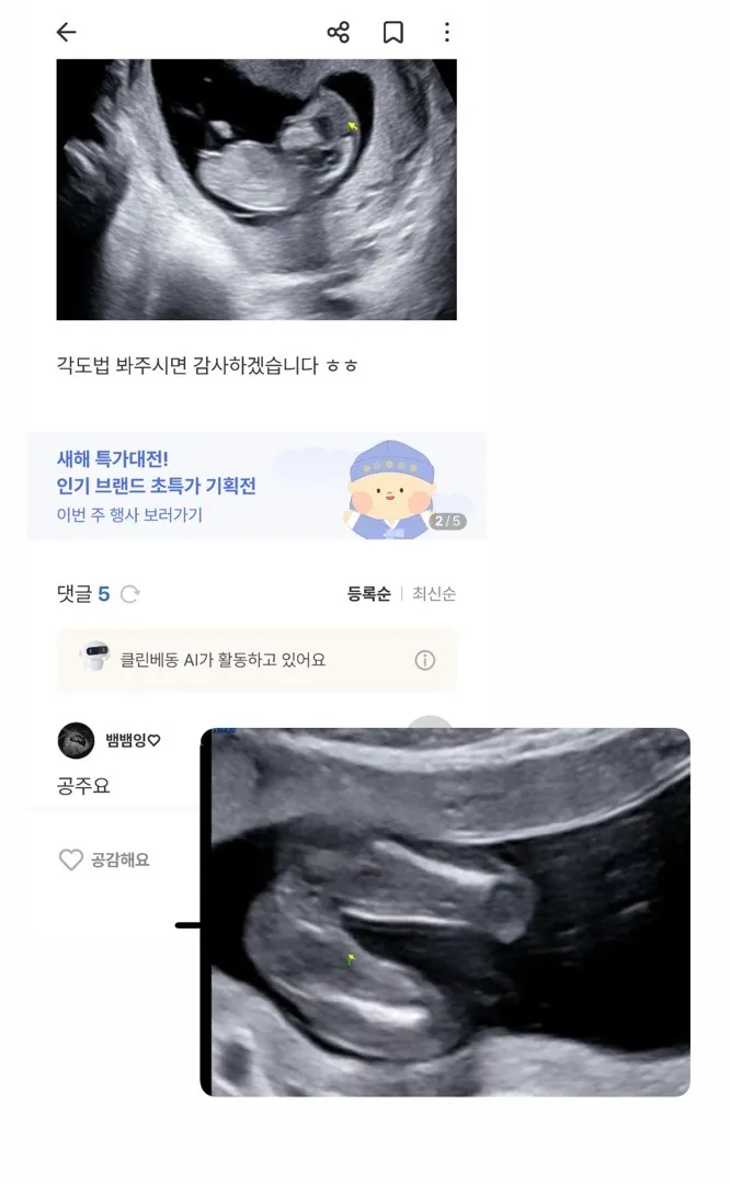 16주 성별확인 딸 맘이에요💗
