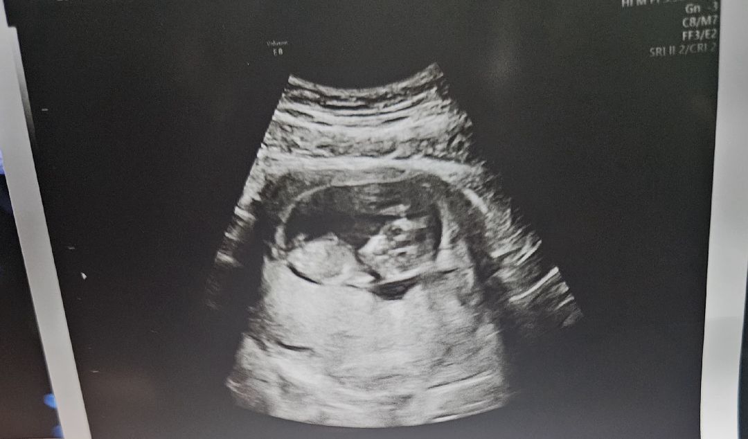 성별