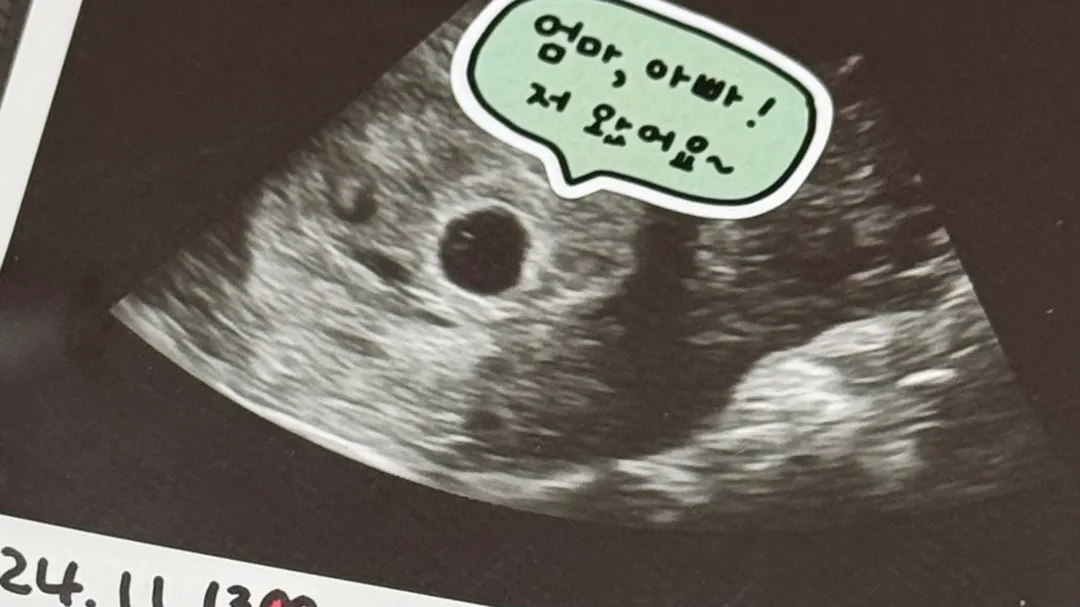 못참고 산모수첩도 받아오고 난황까지 보고왔어요