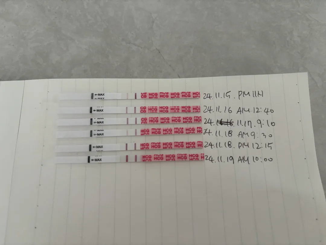 5주 0일차에 아기집 보일까요?