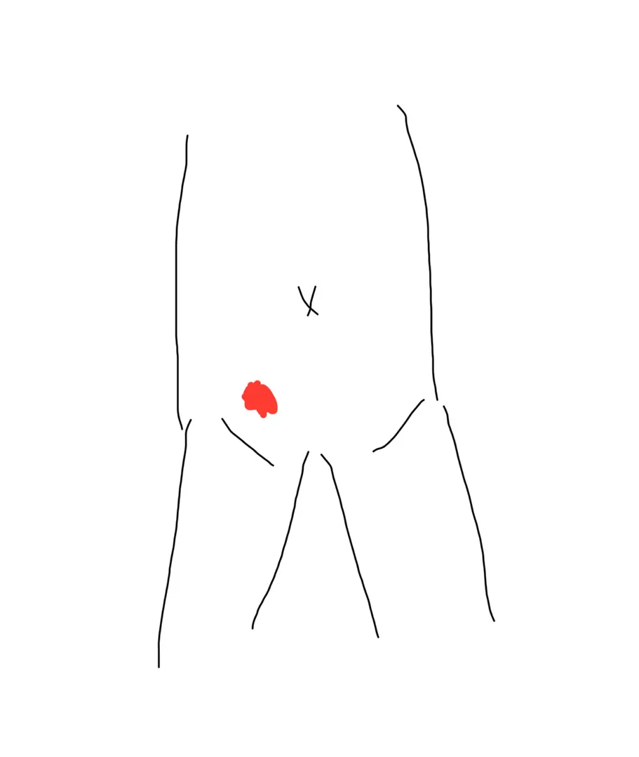 누워있을때 오른쪽 아랫배 통증