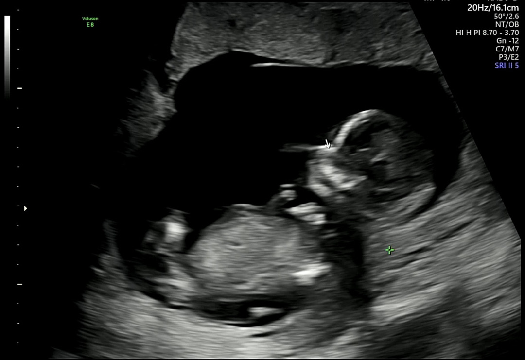 12W6D 각도법 봐주세요 🩷💙