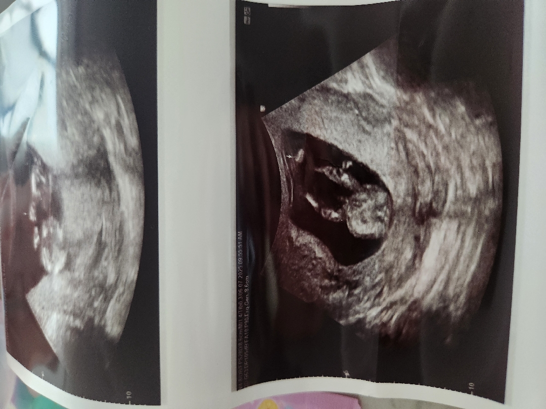 12주6일