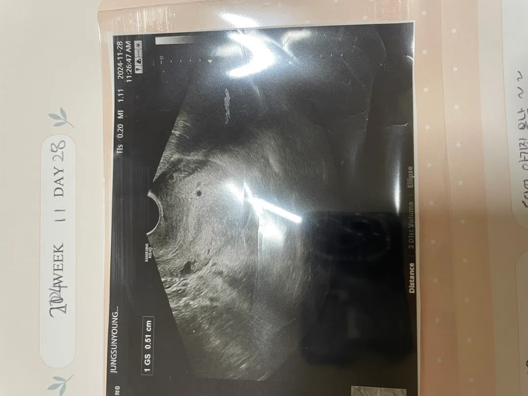 아기집 봐주세요 