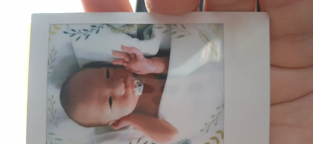 예정일보다 일찍태어난 울애기