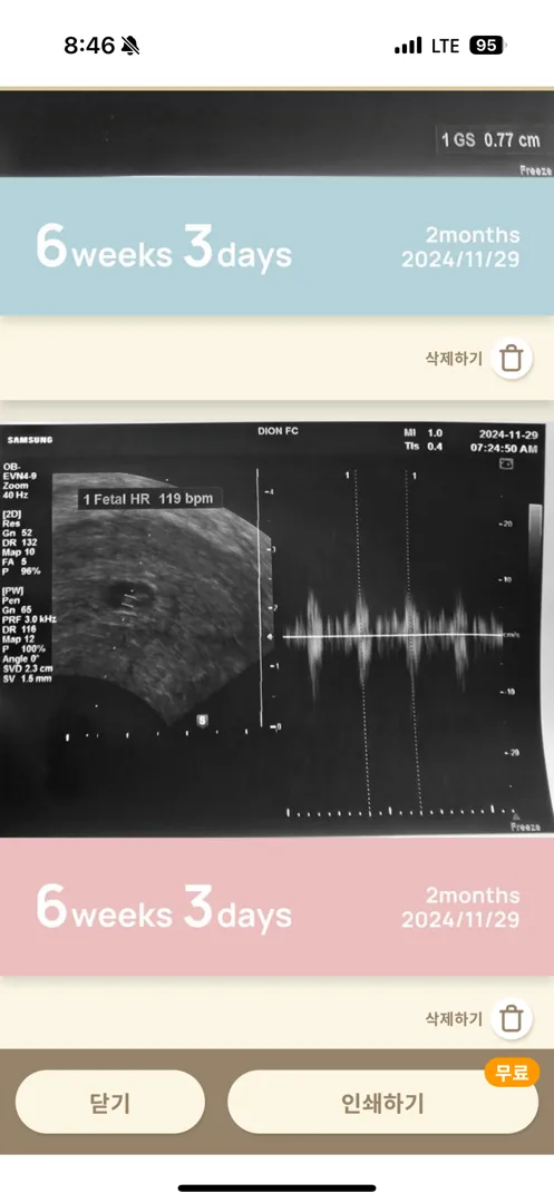 아기집을 크게하려면 어떻게해야할까요?