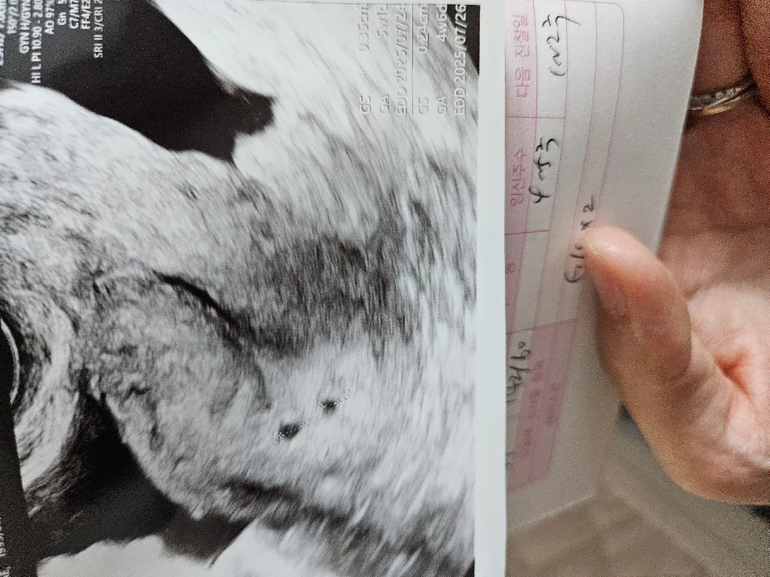 오늘첫초음파