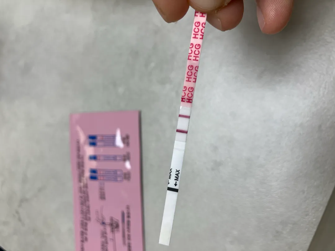오늘 아기집 볼 수 있을까 했는데 역시나,,,