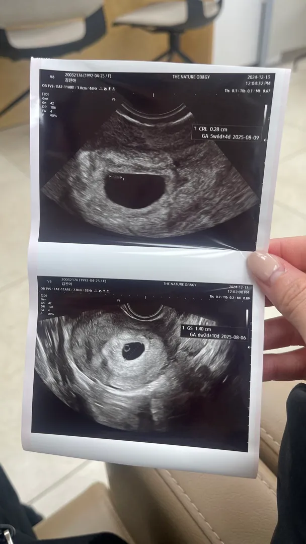 오늘 난황보고왓는데 위치가.. ㅠㅠ