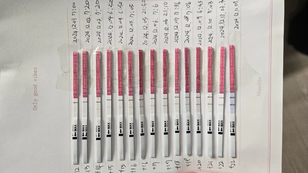 아기집 보러가요~~