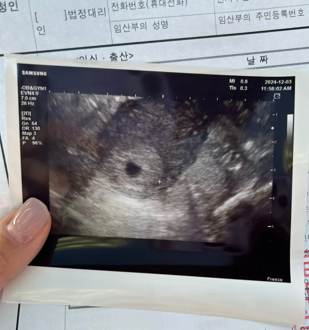 초음파로 아기집 확인하고 보건소 다녀왔어요