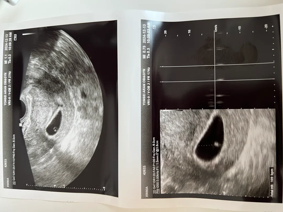 5주차5일  집이 큰건지 아가가 작은건지?