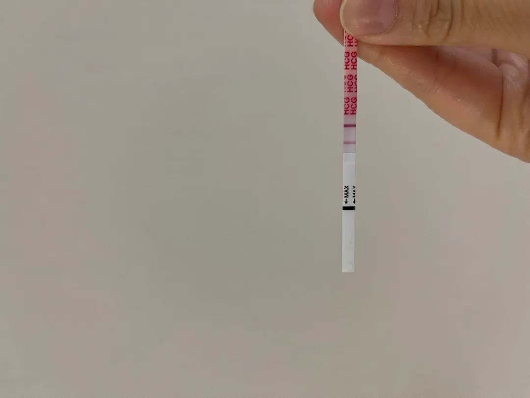 역전안되도ㅜ주말에 병원 가볼까여?