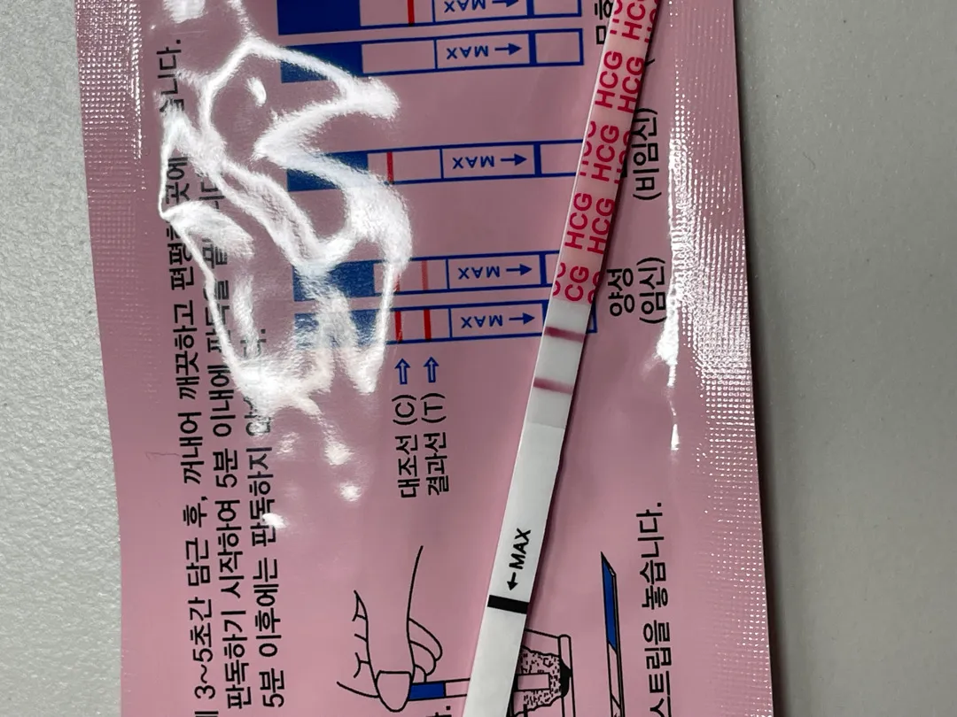 아기집 보러 가도 될까요?!