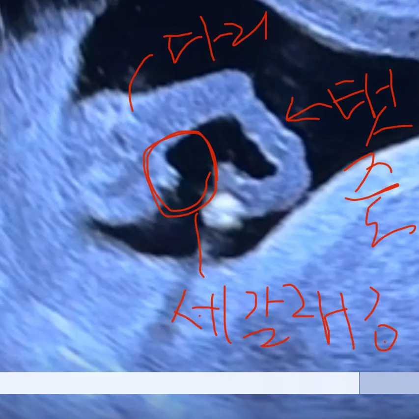 각도법 돌기 삼지창 딸?