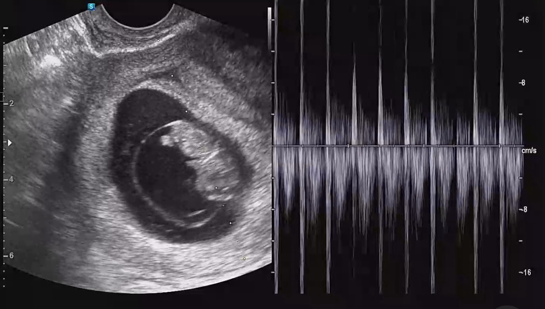 9주차 아기 👶🏻