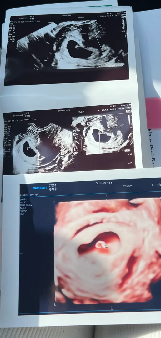 오늘아기집보고왓어용