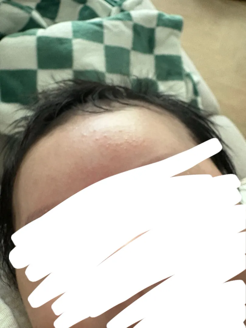 피부좀 봐주세요ㅜ