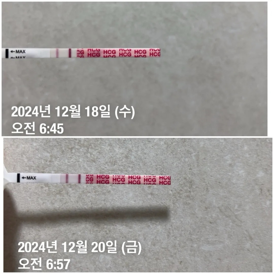 임테기 진하기가 비슷해요ㅠㅠ