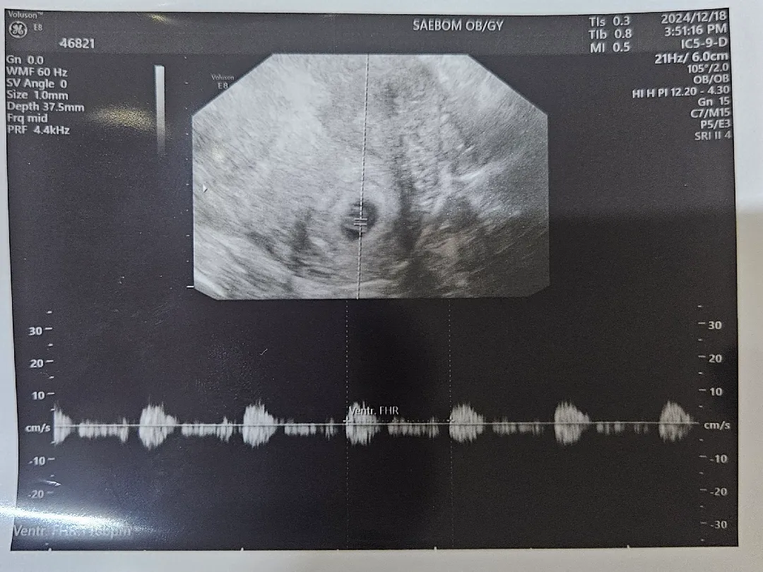 애기 심장 소리가 작다고 하네요ㅜ
