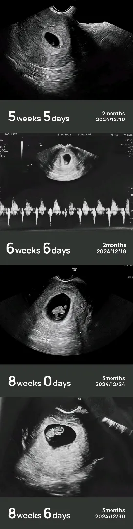 쑥쑥크는 모습 자랑(?) 4주동안 4배큰아기