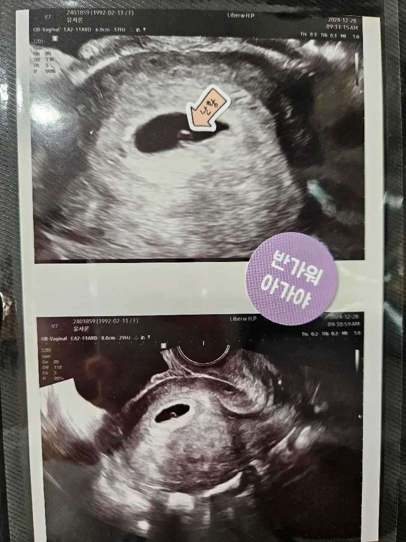 난황보고 왔어요:)