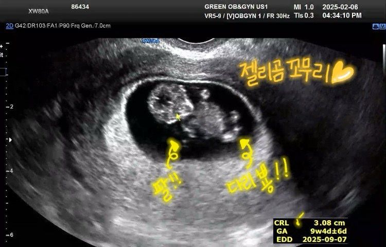 9주6일차 젤리곰 보고왔어요 🥰
