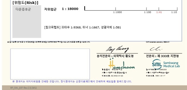 기형아검사 봐주세요