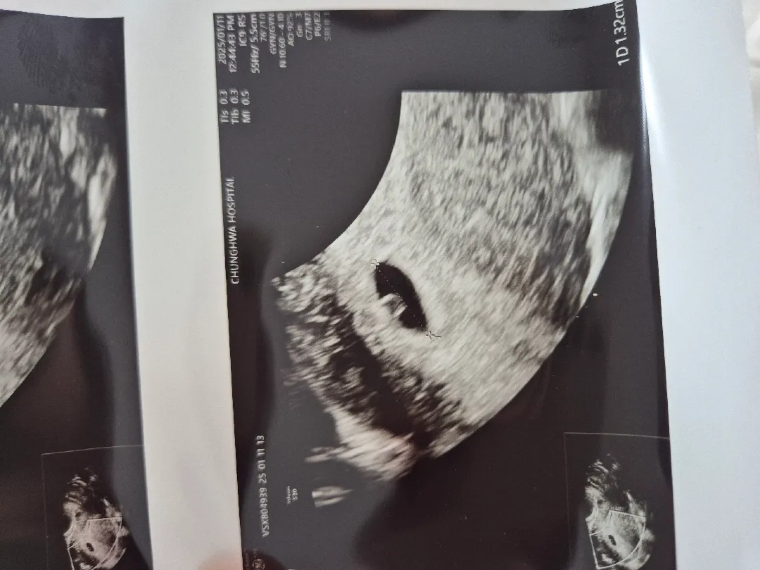 두번째 초음파 보고 왔어요 👶🏻