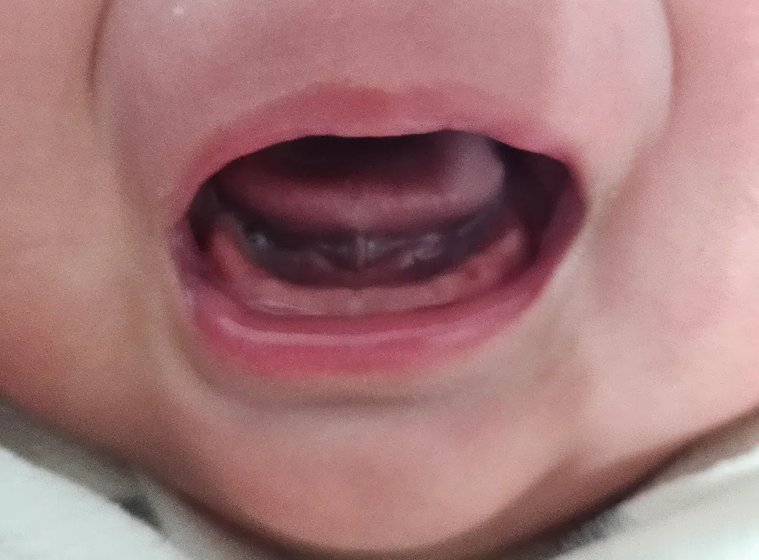 이앓이 인가요??