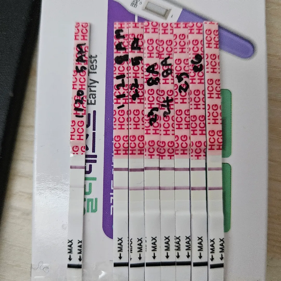 오능 아기집 보고 왔어용 ㅎㅎ
