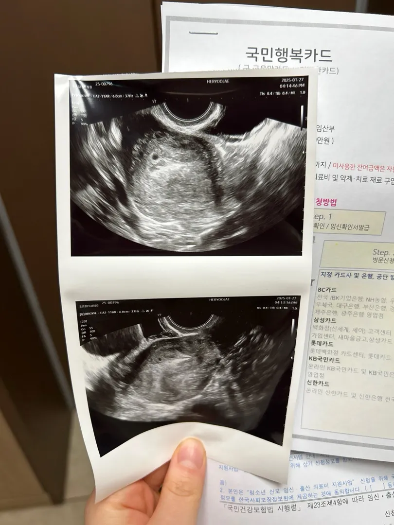 아기집이 맞을까용..?